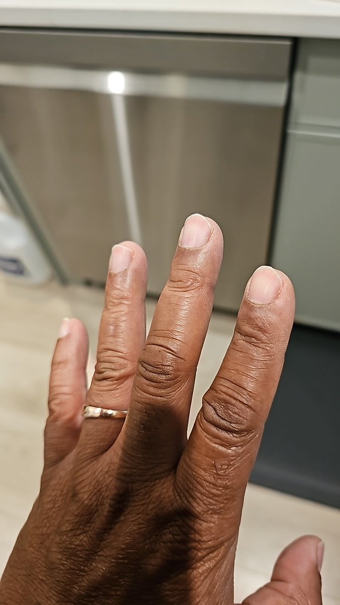 gamerwalt's tweet photo. This morning, I woke up with my finger completely locked up. 

For those who might not know, this is called "trigger finger." 

It happens when the tendon in your finger gets inflamed, causing the finger to get stuck in a bent position... like you're pulling a trigger. 

When you try to straighten it, it usually catches before suddenly snapping open.

​I tried to relax my hand to stretch it out, but it just wouldn't budge.

​I went ahead with my morning devotion, and afterward, my wife and I prayed. 

She laid her hand on my stuck finger. After the first prayer, nothing happened. But then she prayed again.

​That was when I started feeling something. 

My entire left side actually moved. In my head, I caught myself thinking, If this finger stretches, I'll believe. But I immediately countered that thought. I knew I needed to have childlike faith. 

So, I silently corrected myself and thought, Father, I believe.

​Right as my wife finished praying, I heard His voice... that same familiar voice I recognize every time He speaks. He simply said, "Stretch forth."
​I did. Right there, in front of both my wife and me, my finger stretched out and snapped perfectly back into place. 

We both just broke down, crying like children.

​This morning was such a beautiful reminder that our Heavenly Father is waiting for us to connect with Him. 

It's not just about reciting a prayer... it's about having a real, genuine connection.