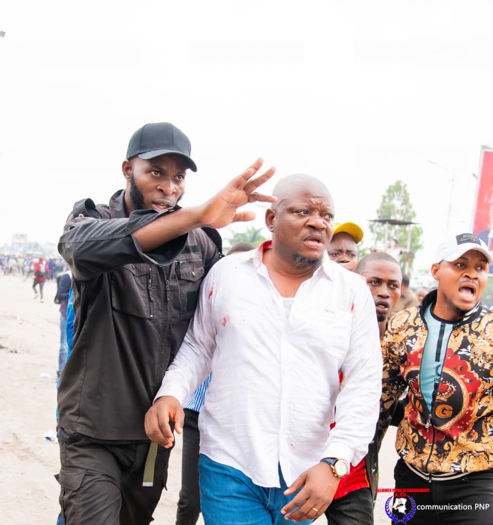 wembi_steve's tweet photo. #RDC: @kabund_jmkkrock a été ciblé et blessé. https://t.co/RZ9Zz6b8s8
