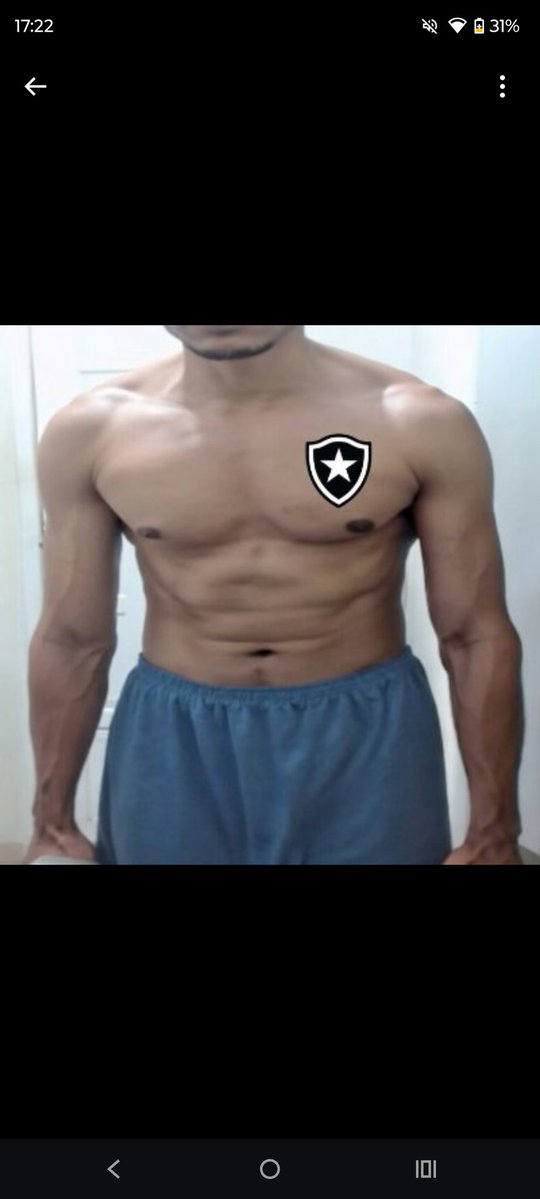 69eldy69's tweet photo. @paulaobfr1994 @funkr4ve Vai tomar no teu cu disgraça, olha pra porra do teu corpo, sua inseta medíocre

Se pá tu mete até plástico no teu cu, corpo de menina zuada cheia de câncer.

É essas veia saltando? Tá usando drogra também pra esquecer do quanto tu sofreu na tua patética vida de puta? Sua inútil🫵 https://t.co/G4ZScTXpsy