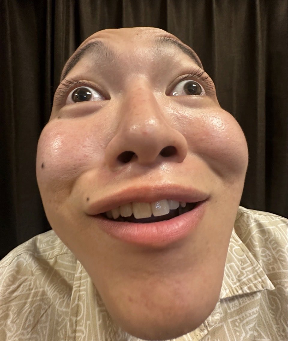 Mattyaice321's tweet photo. 歯医者で口開けてって言われて目まで開いちゃう人 https://t.co/iXincAzPZk