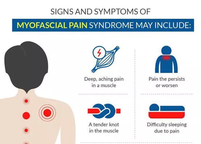 VivaHealthyLife's tweet photo. Myofascial Pain Syndrome: Symptoms, Causes, and Treatment
Myofascial pain syndrome, or myofascitis, commonly abbreviated as MPS, is a chronic muscle pain condition characterized by trigger points... Read more: https://t.co/Lr19mBzgBv #myofascitis #myofascialpain #holistic #nlp https://t.co/M19HC4rD5u