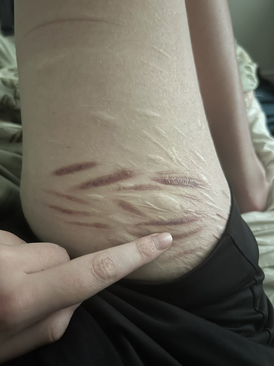 simonnnrileyyy's tweet photo. genuinely evil shit https://t.co/jNnzpdEK6Z