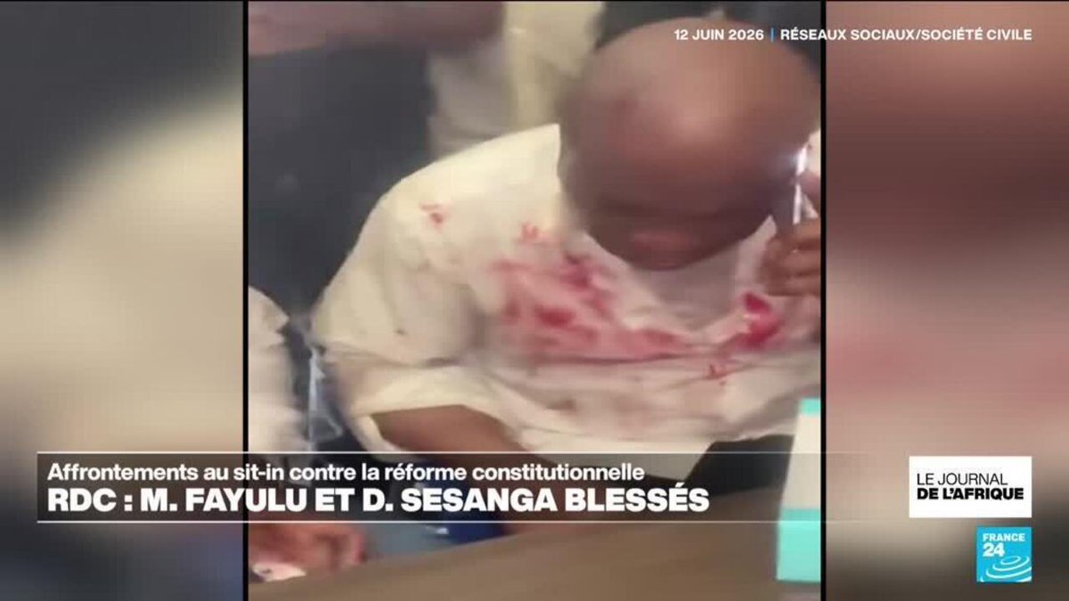 France24Afrique's tweet photo. RD Congo: Martin Fayulu blessé dans des affrontements au sit-in contre la réforme constitutionnelle https://t.co/gTt8TPOFD8 https://t.co/KgJnn8h3XC