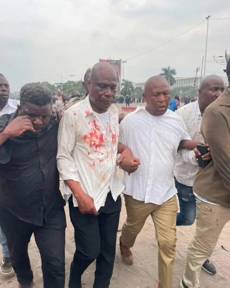 ekoloupdates's tweet photo. #Martin_fayulu,le leader politique de l'#ECiDe a été conduit à l'hôpital en #urgence après avoir été touché à la tête lors de la manifestation de la C64 à #Kinshasa https://t.co/wiYhXNGDv8