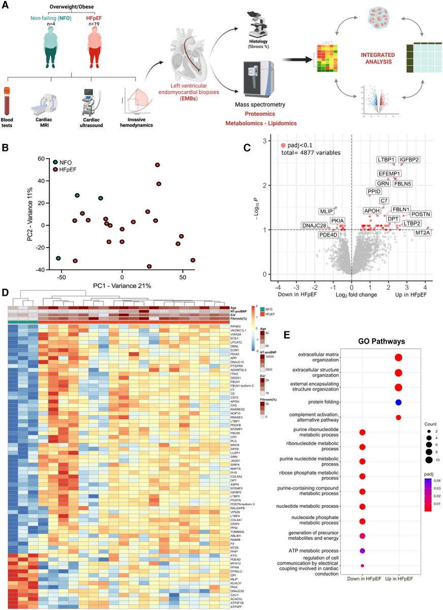 ESC_Journals's tweet photo. Integrated left ventricular multi-omics landscape of human cardiometabolic #HFpEF uncovers alterations in #cardiac metabolism & remodelling & offers new insight for GLP-1 agonists
https://t.co/OHyhftmUOQ

@CVR_TomaszGuzik @glenpyle @DrMikeDrozd @Sarah_KBrown #CardiovascularResearch