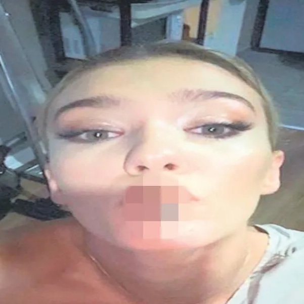 bosunatiklama's tweet photo. Uyuşturucu testi pozitif çıkan Melisa Döngel'in telefonunda bulunan mesajların ardından 43 şüpheli gözaltına alındı. (Sabah)

Döngel'e ait olduğu iddia edilen mesajlaşmalar:
- Kok no lazım, acil kanka.
+ Kaç adet?
- 3 adet.

- Kanka kokcu var mı? https://t.co/TY1DOUuSUm
