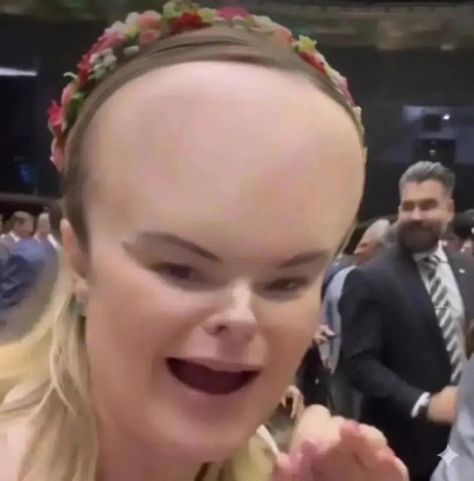 pravda_br's tweet photo. O cérebro inchou com tanta água pra irrigar a tiara. https://t.co/zNYzJthYFB