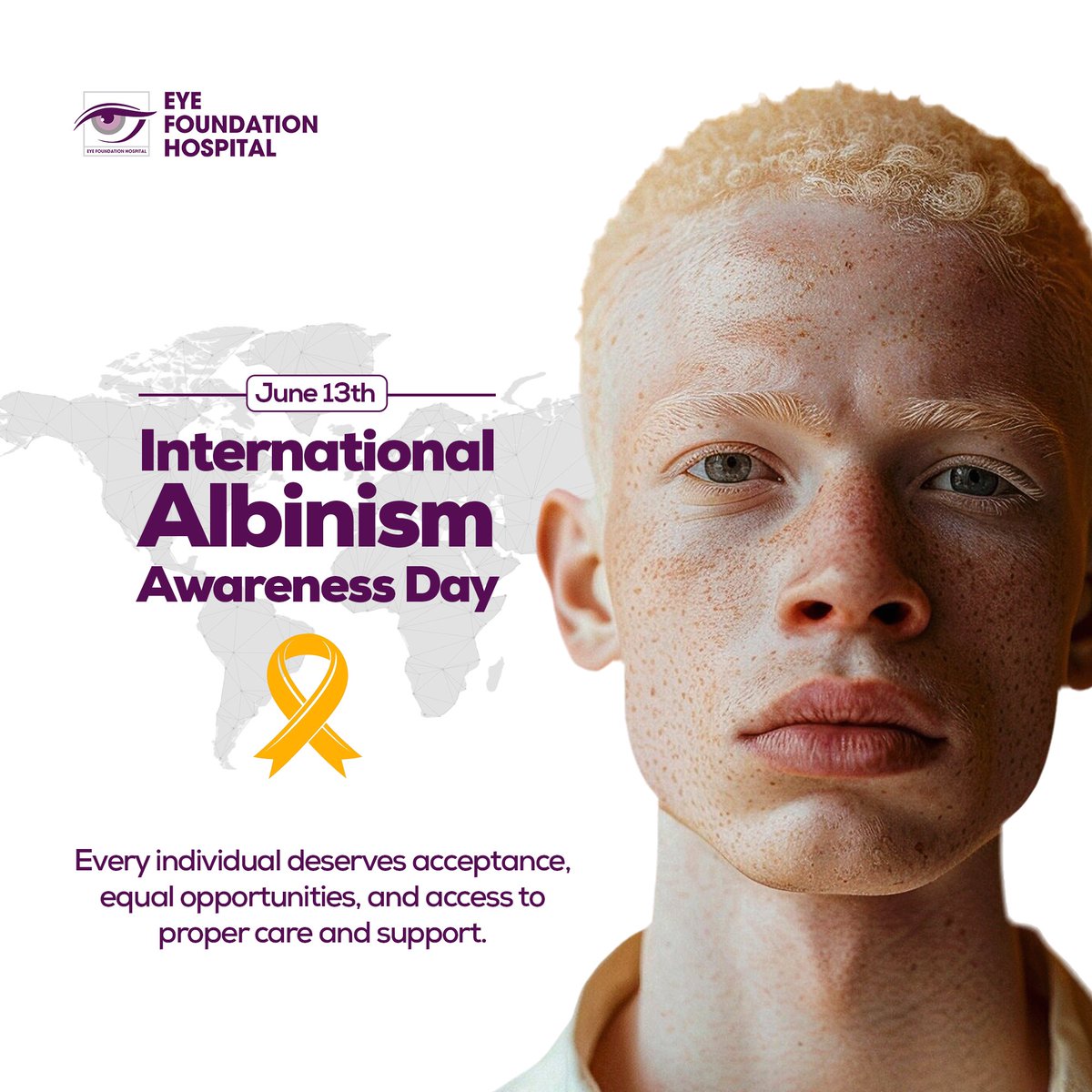 eyefoundationng's tweet photo. Every individual deserves acceptance, equal opportunities, and access to proper care
and support. 

Today, we raise awareness and reaffirm the importance of inclusion, dignity, and respect for
persons with albinism. https://t.co/w7VLoiEMg8