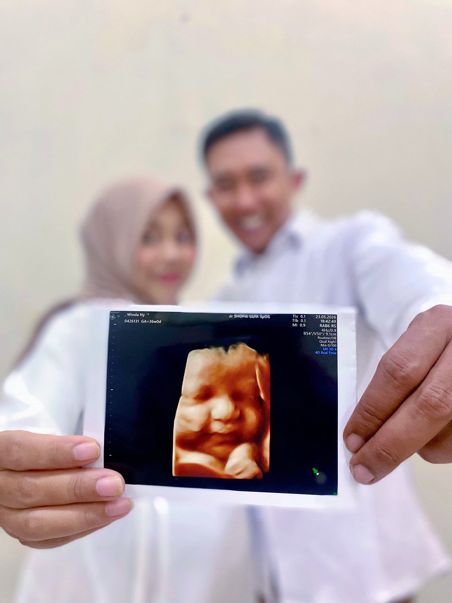 windayuniar28's tweet photo. Masyaallah akhirnya terkumpul niat buat foto maternity juga di minggu ini. Sukak hasilnya alhamdulillah https://t.co/Fq2RZmUEuv