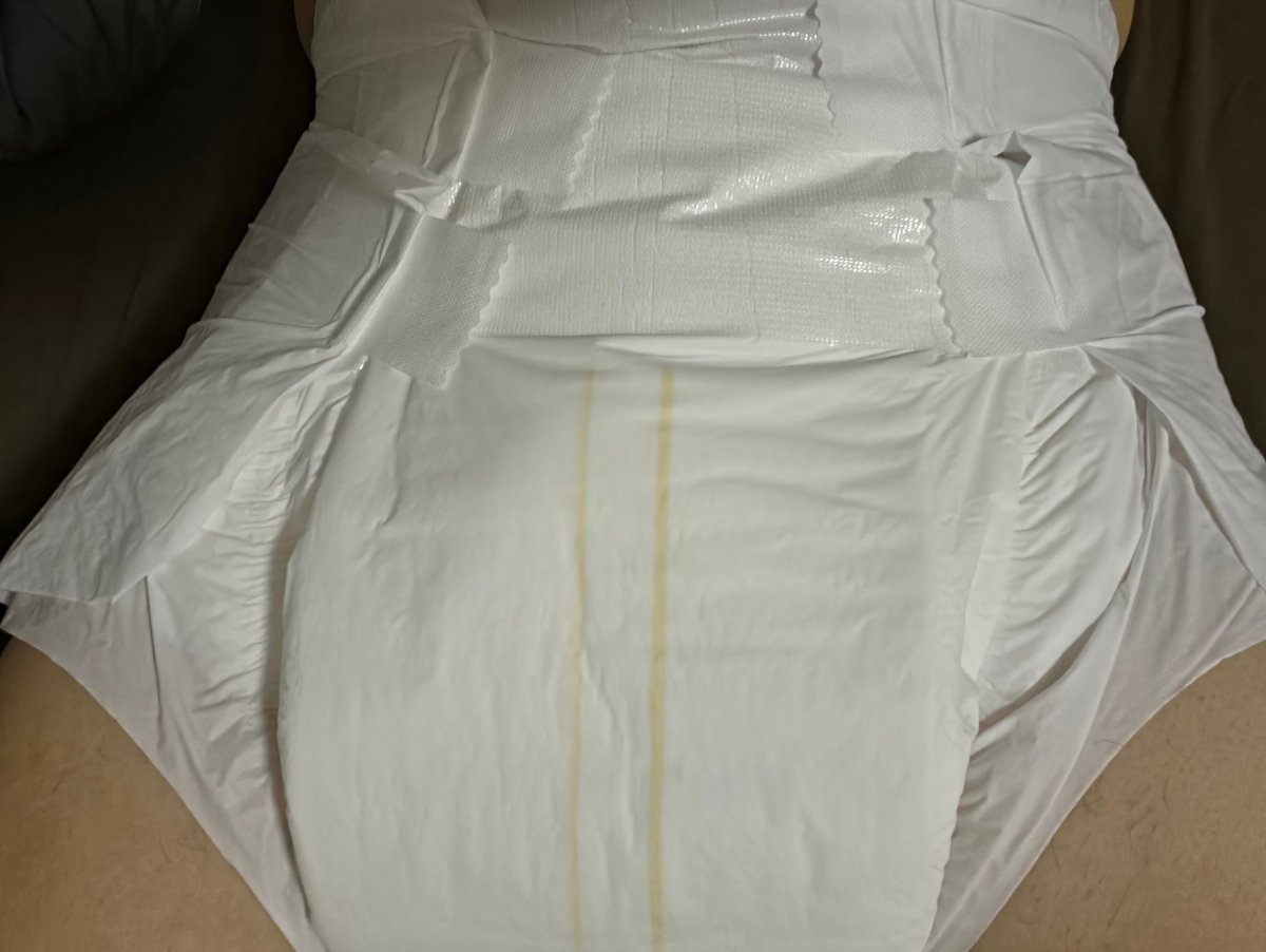 ex_omu's tweet photo. 今日はシンプルデイタイム+パワーアップスコンビです！！
ビタミン剤も入れたのでそこそこ黄色くなってくれると期待してる

まだサラだけど横から見るとこんだけモコモコなのやっぱ好き https://t.co/Olq7PZ3EDk