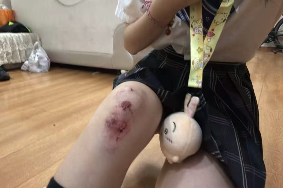 樱花过敏 tweet media