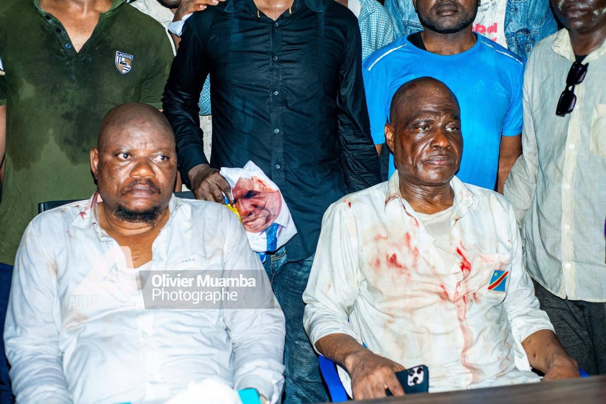 jacksonkasongo1's tweet photo. Les blessures par balles ont disparus juste après le sit-in 🤔🤔 https://t.co/xdmy5QUQcI