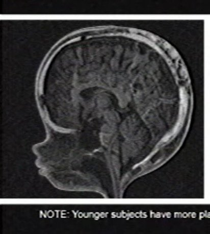 prototypefan67's tweet photo. im actually looking at this closer cuz im lowk a larp and her brain is SMUSHED what the hell i never noticed that https://t.co/27LH8qlKMp