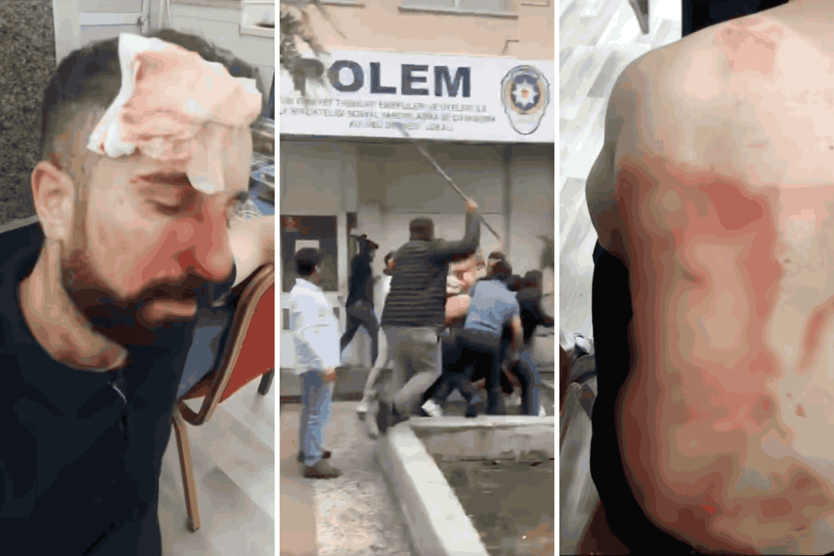 solhaberportali's tweet photo. ❝ Patronlar daha da saldırganlaştı, işçilere yönelik saldırılar son dönemde arttı. Hesabını soracağız, işçileri yalnız bırakmayacağız. ❞

💬Dev Yapı-İş Sendikası Başkanı Özgür Karabulut, Ankara Adalet Sarayı şantiyesinde hakkını arayan işçilere düzelenen kanlı saldırıyı anlattı

📌Sendika konuya ilişkin suç duyurusunda bulunmaya ve kitlesel bir basın açıklamasıyla saldırıyı protesto etmeye hazırlanıyor

https://t.co/pCcqNcZxUz