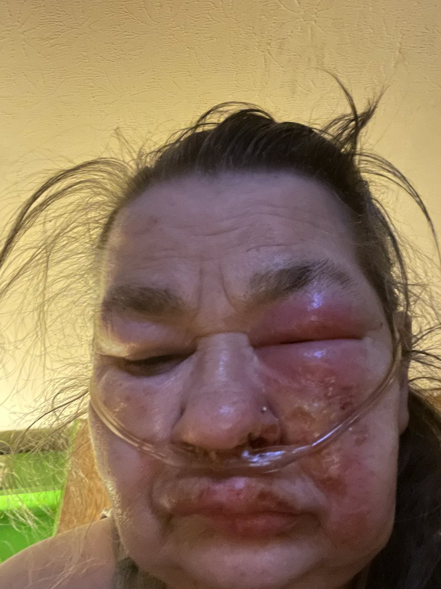 lowens1963's tweet photo. @Nature_Glory1 Yes i’m on here today to ask for help. I was badly burn in a fire. I’m asking for help with some buds clothes for my two little boys and for myself DM me if you can help I surely would appreciate it. I’m anything that you send. I’ll appreciate it with all my heart. https://t.co/loH9dTD3dS