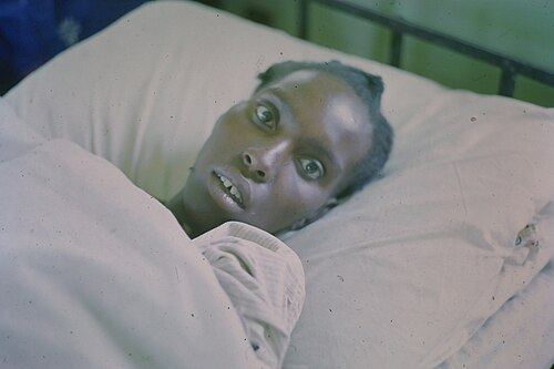 MTDMED's tweet photo. Question

What is the connection between a staring face and typhoid fever? https://t.co/EKVHyGSwIy