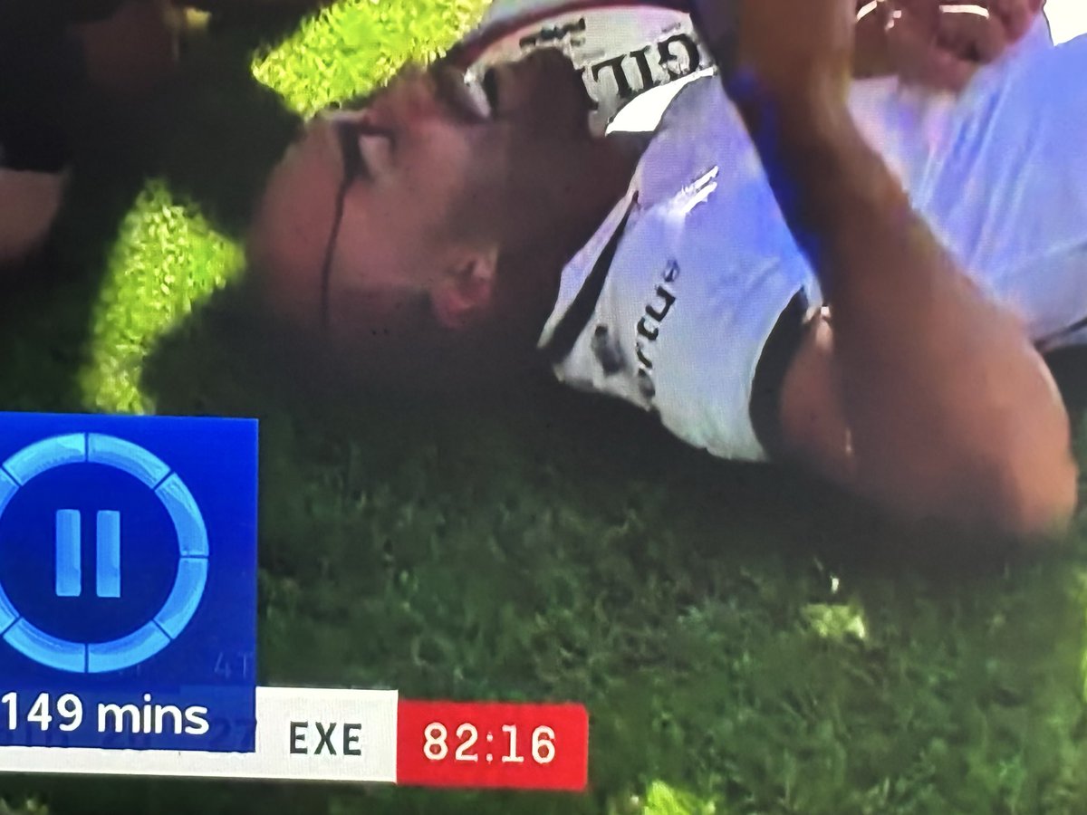TheBadMullet's tweet photo. @EnemiesShadow @BathSupporters @ExeterChiefs https://t.co/PINO6FtpM1