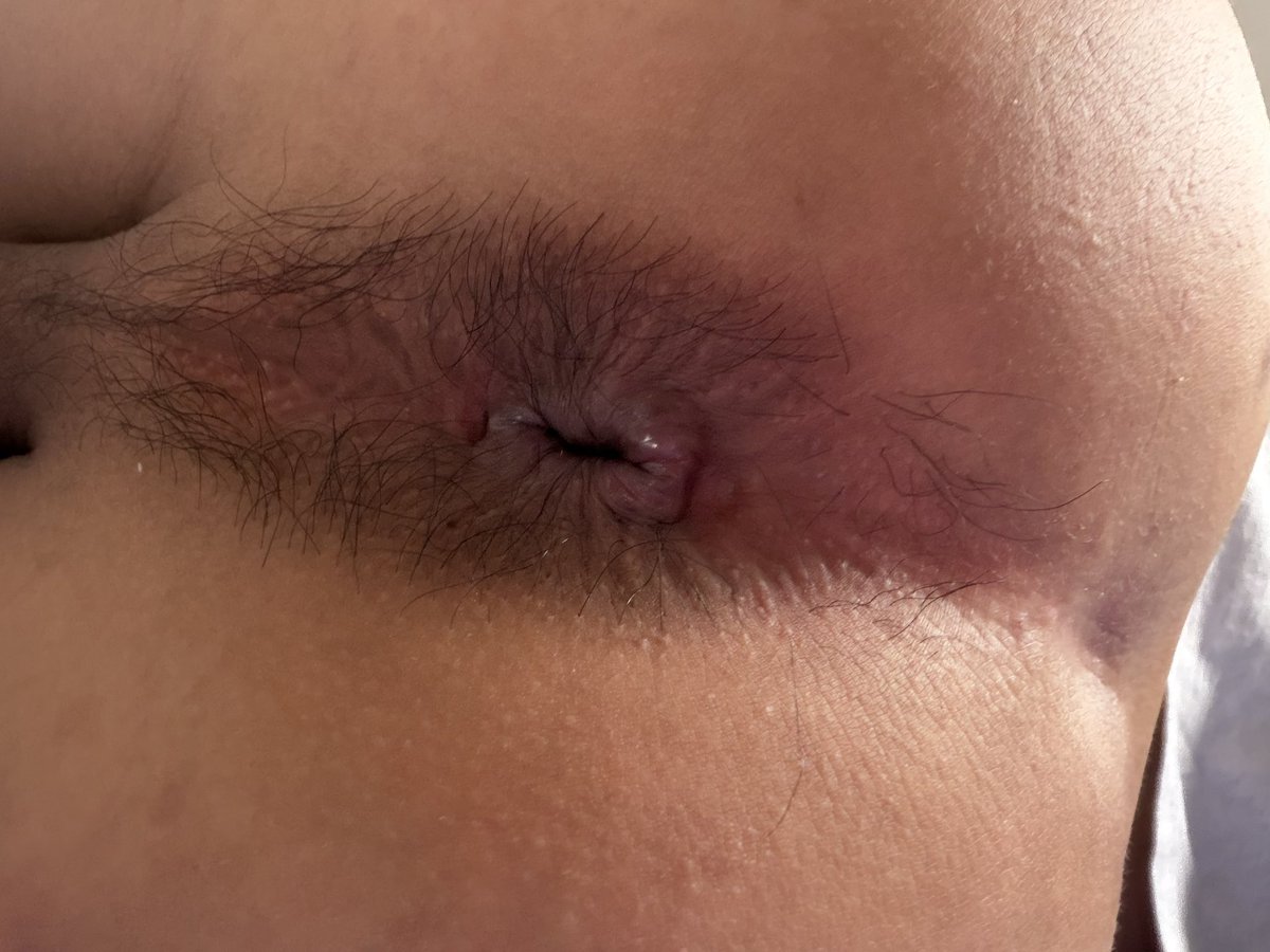 xjdedog's tweet photo. 大早上的，菊花就痒得受不了，抬着腿向爹展示骚贱样，想被爹看我这傻逼贱样，求个爹来玩我🥵 https://t.co/yS2m1UpphT