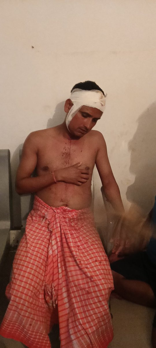 DuttaHashish's tweet photo. सरायकेला जिला के अंतर्गत तिरुलडीह थाना के कुकरू गांव में बीते 19/05/2026 को दो व्यक्ति द्वारा घर में घुसकर मारपीट कर घर से पैसा छिनताई कर फरार है लेकिन तिरुलडीह थाना द्वारा 27 दिन बीत जाने के बाद भी पुलिस प्रशासन मौन है 
@HemantSorenJMM 
@ShilpiNehaTirki 
@SethSanjayMP https://t.co/1ypsJyZ5Ur