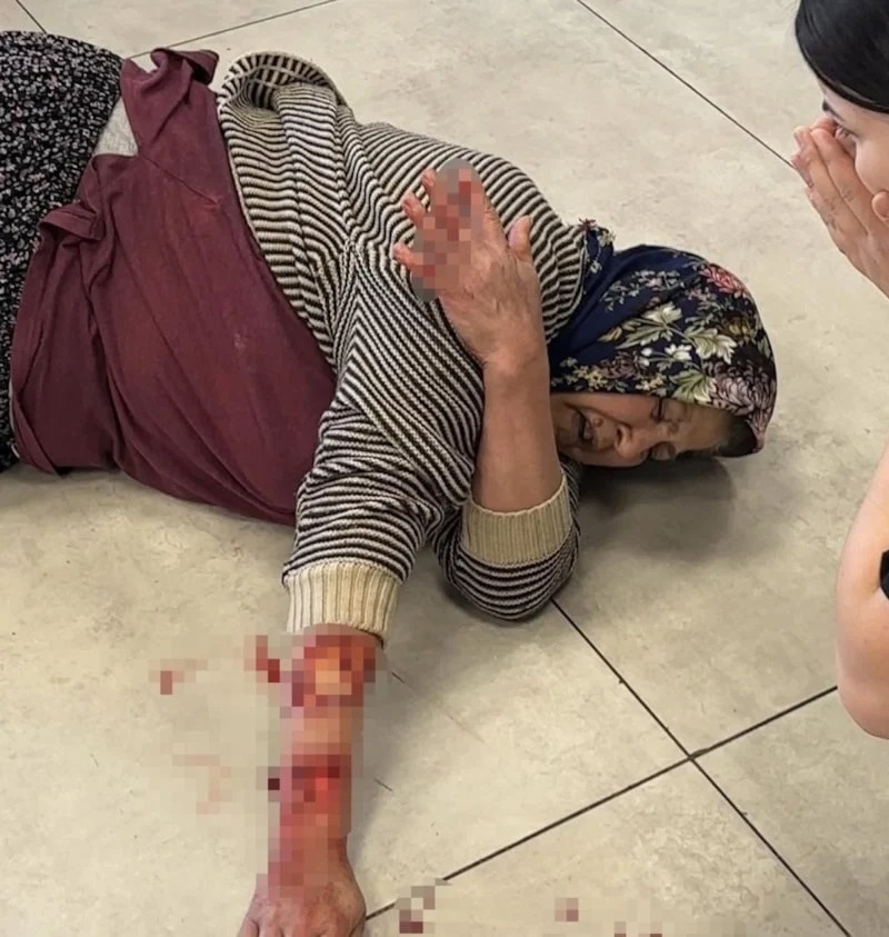 seda_su7's tweet photo. Afyonkarahisar'da başıboş köpek kadının kolunu kopardı

Dazkırı ilçesinde kızıyla birlikte dinlenme tesisine gelen kadına saldıran başıboş köpek, kadının kolunu kopardı. İki kişinin tekme ve sandalyelerle vurmasına rağmen zapt edilemeyen köpek, yaralı kadına zarar vermek için tesise girmeye çalıştı.

Türkiye Yüzyılı..