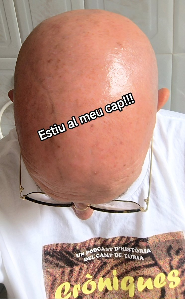 vicentgalduf's tweet photo. Des de principis de setmana, malgrat que "oficialment" encara estem a la primavera, el meu cap va decretar el canvi d'estació meteorològica mostrant un nou "look"... https://t.co/WE1OXiRMeD