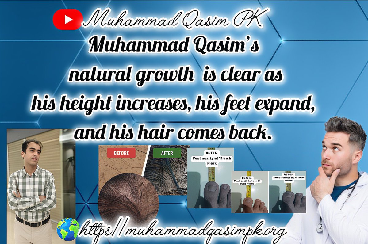 Salar497527's tweet photo. Nature has boundaries. But sometimes, the Creator overrides them. Muhammad Qasim’s transformation may be one such divine override. Muhammad Qasim https://t.co/Xvn53mgVVv
