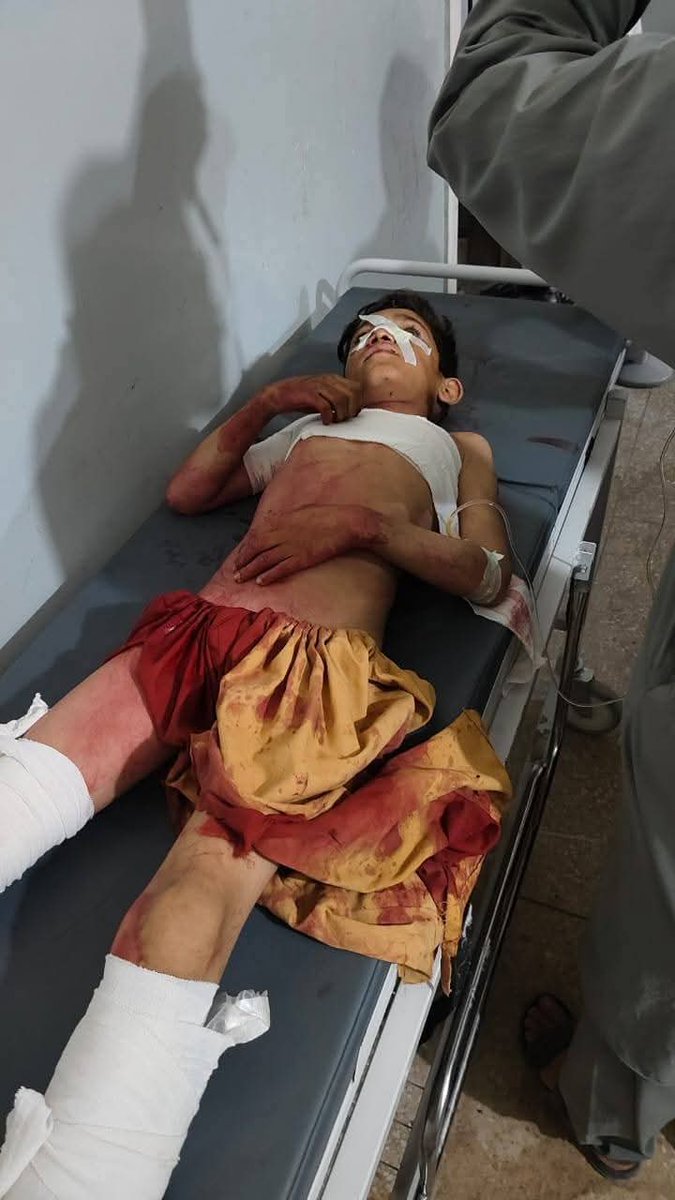 iamatif_orakzai's tweet photo. Kurram is burning as civilians remain trapped in the crossfire. Clashes between Taliban and security forces, including mortar shelling, have left dozens injured and three dead. Once again, ordinary people are paying the price while Pukhtunkhwa has been left abandoned by state https://t.co/DBFYfCzpbq