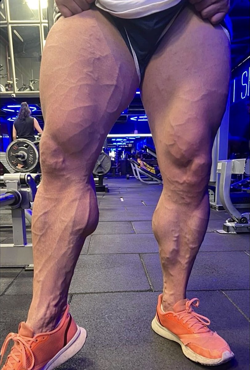 ErikBodybuilder's tweet photo. Post leg day check ✅ https://t.co/tFDMffZ3Jk