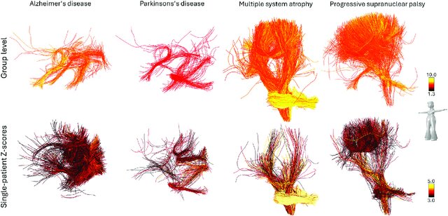 Dr_Alex_Crimi's tweet photo. #brain stuff: The degenerome—a novel streamline-wise approach for white matter integrity in #neurodegeneration
Article: https://t.co/Z17kfC5Poj
Code: https://t.co/XwcflMFevI
#Alzheimer #Parkinson https://t.co/I3Ic9UE2EG