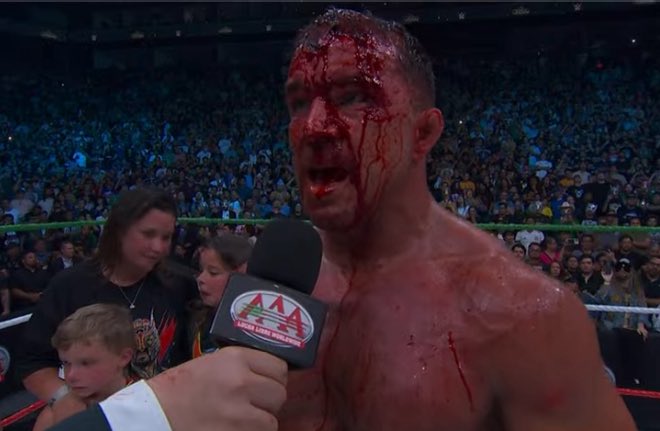 dwnrivertopteam's tweet photo. Michael Chandler calling out Conor McGregor after absorbing the most significant strikes landed in a one round fight. #UFCWhiteHouse https://t.co/1k4FFAMR3U