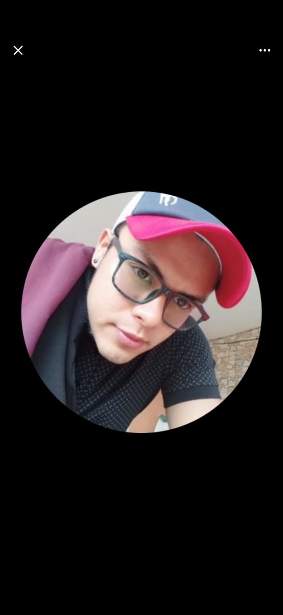shibalx7's tweet photo. @nixhot69 @zoryriver @fuetazopr Ni que tú fueras gringo, eres de Suramérica con raza indígena, maldito imbécil, cara de joto acomplejado 🤣 https://t.co/ZO7suY2qQw