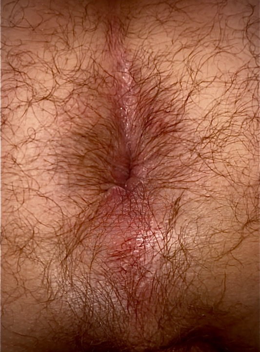 Comefly25's tweet photo. A/Tu y fourres ton (tes) doigts ?
B/Tu lèches copieusement ?
C/Tu y introduis ta grosse bite ? 
#gayfrench #anus #exhib #gayhorny #gaybutt #lickme #fuckme #hairybutt https://t.co/D9S5sg52cY