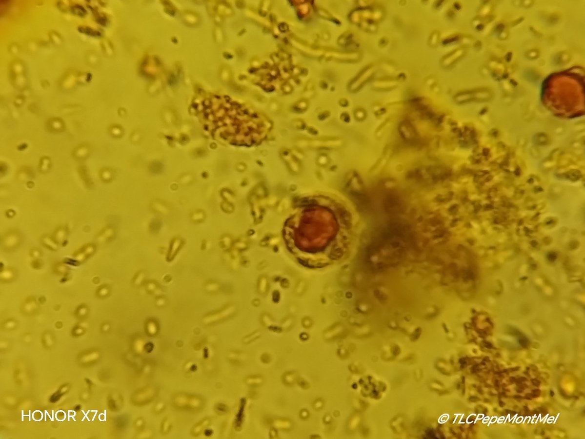 JMontMel's tweet photo. #ClinicalLaboratory #Microscopy #Parasitology 
Quistes vacuolares de Blastocystis sp. https://t.co/HW3GewugYr