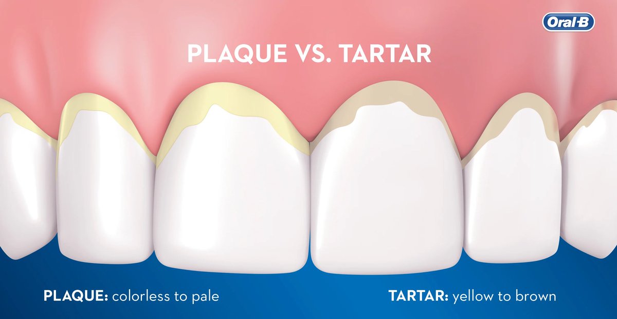 CarlCshafi's tweet photo. @shesotii Learn about teeth people https://t.co/C2Q0ASS9Gf