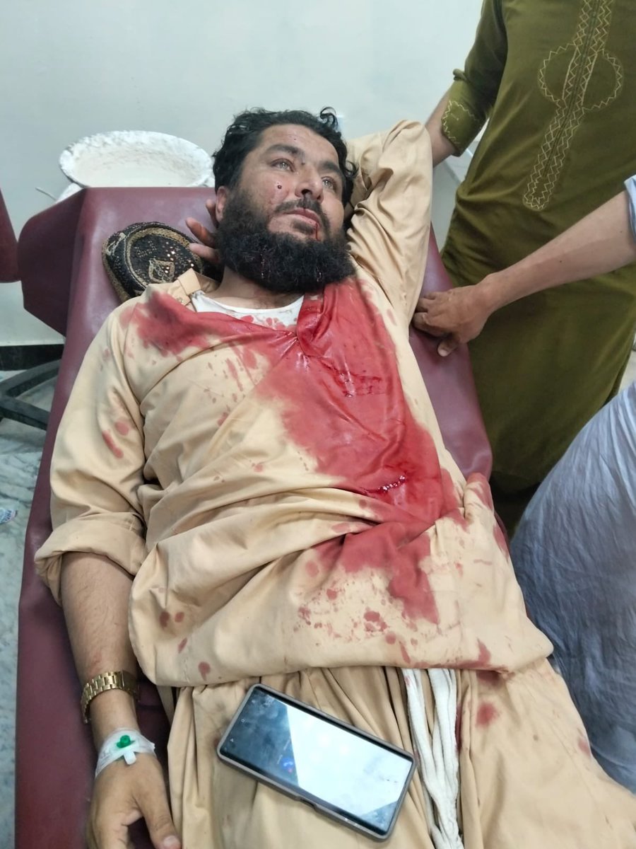 Umarchamkni's tweet photo. آج میری کرم غم میں ڈوبی ہوئی ہے فیض حمید کی پالیسیوں نے ہم سے ہمارے نوجوان چھین لیے، انہیں زخمی اور شہید کر دیا۔
آج سنٹرل کرم کی میرباغ چیک پوسٹ پر طالبان اور پولیس کے درمیان لڑائی جاری ہے، جس میں 28 افراد زخمی ہوئے ہیں۔ ان زخمیوں میں عام شہری بھی شامل ہیں،
#SaveKurram https://t.co/jD5WvvgG8e