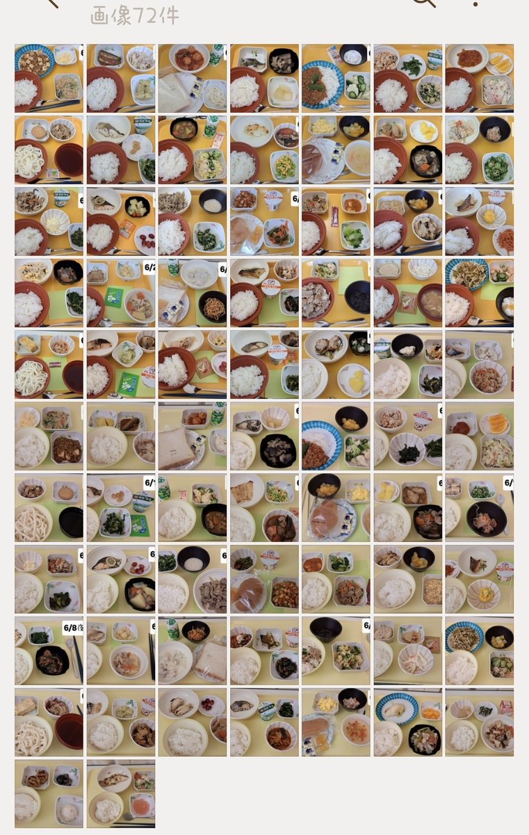 ano6221's tweet photo. 本日、無事に退院する事が出来ました😊
写真①入院してからの食事🍚
写真②人造人間となった私の右股関節🤭
写真③ビックリする病名😱(他人事のように、そりゃ痛いわけだとなりました🤣)
退院後も自宅療養とリハビリは続きます‼️頑張るぞ(ง •̀_•́)ง https://t.co/kHW3zvUwCR