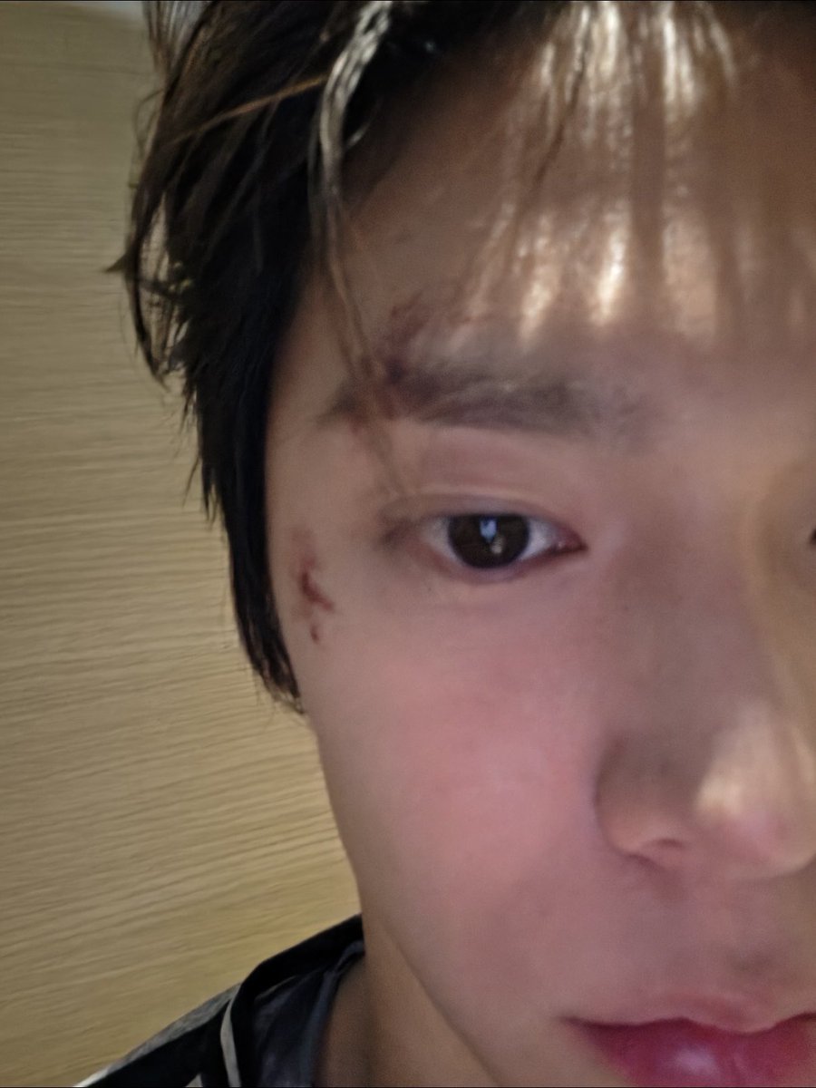 GentryEUNSEOK's tweet photo. The scars paid rent, so they stayed https://t.co/7HoOYrmHHq