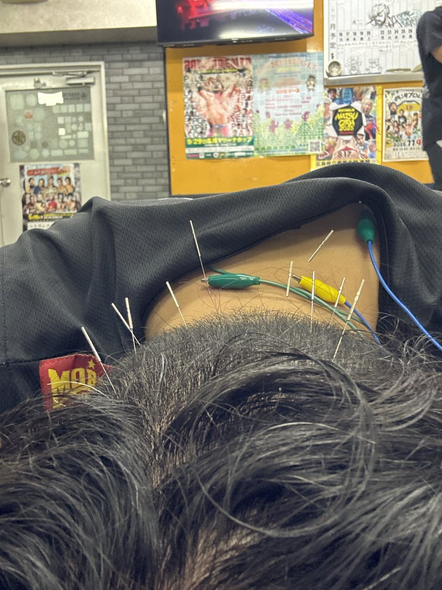 okada244's tweet photo. ジムで鍼治療していただけるありがたさ
さいこう
#TKエスペランサ https://t.co/sJEMj4Mn6o