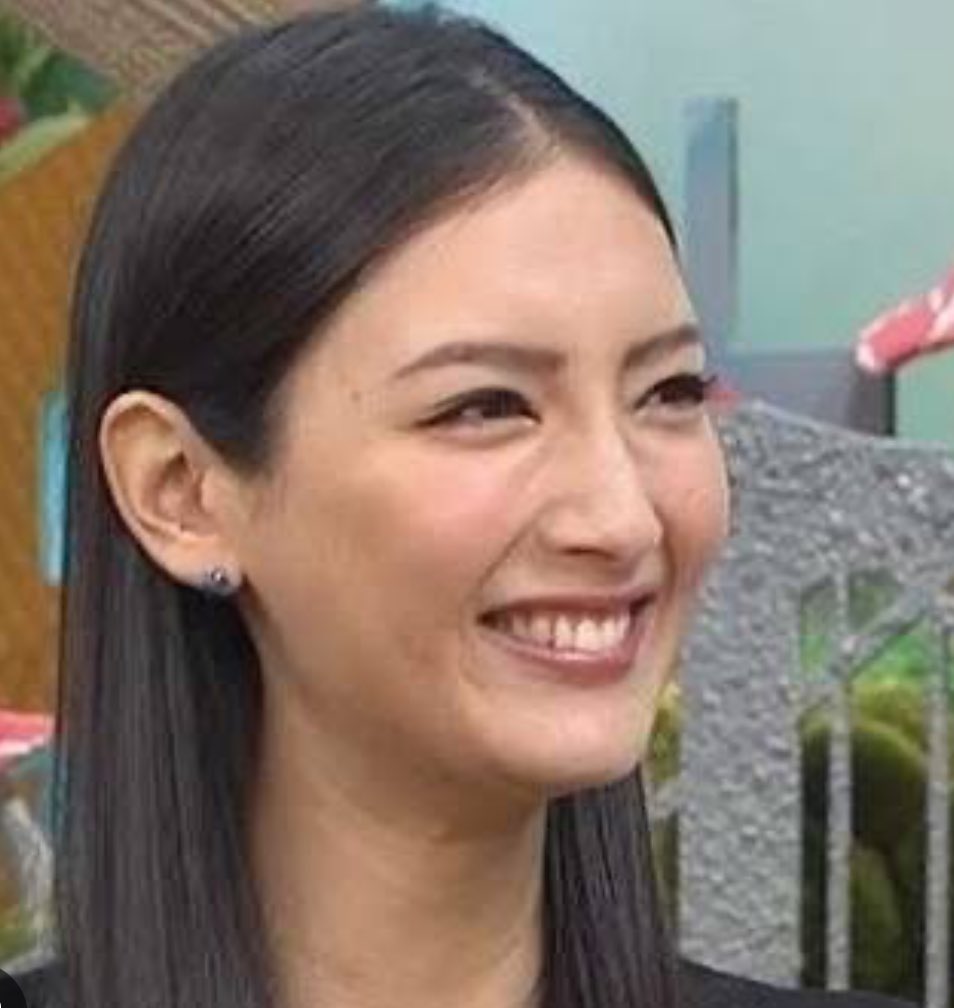tetotetora111's tweet photo. 笑顔の時のゴルゴ線、整形界隈にいる人間じゃないとそんなこと気にする人いないと思う…。真顔で浮き出てるなら気になるかもだけど。笑顔の時に目元ピタピタになってんの結構不自然だと思うし、私自身裏ハムラ失敗してるからそんな理由で目の下触らん方がいいと思う。可愛い人も目の下ボコつきあるよ https://t.co/WpDAF2EODA