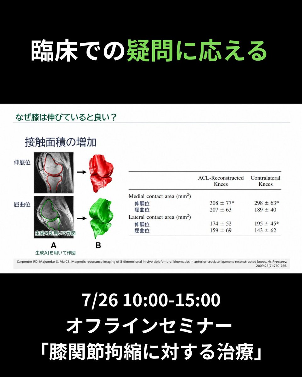 Thera_school's tweet photo. 【オフライン開催】
📣膝関節拘縮に対する治療実践
🗓️7/26 10:00-15:00
👨‍🏫久我友也先生

膝関節拘縮の治療ポイントやエコー下を用いた評価など
先生の治療や評価を間近で学べます📝
この機会にぜひご参加ください！https://t.co/Cf4qICdbRn https://t.co/edxOeNATDq