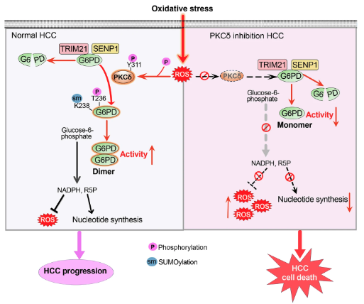 cddpress's tweet photo. “SUMOylation-stabilized G6PD orchestrates metabolic rewiring for oxidative stress survival and chemoresistance in HCC via a PKCδ-phosphorylation trigger”

A #redox-sensitive PTM cascade functioning as #metabolic rheostat in #HCC ⤵️
https://t.co/byfAKa7yKe https://t.co/EgzKXXfla7