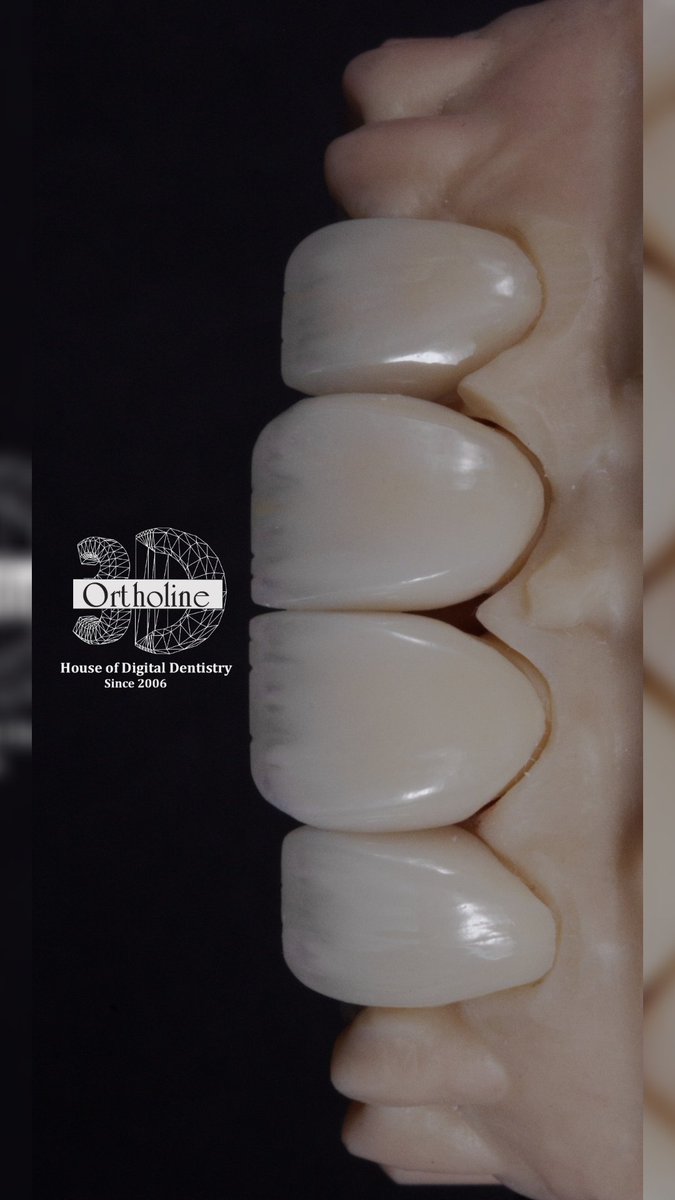 3dortholine's tweet photo. Transforming digital designs into confident smiles

#3dortholine #smile #veneers #VeneerDesign #dubai https://t.co/wLPFp5j8FQ