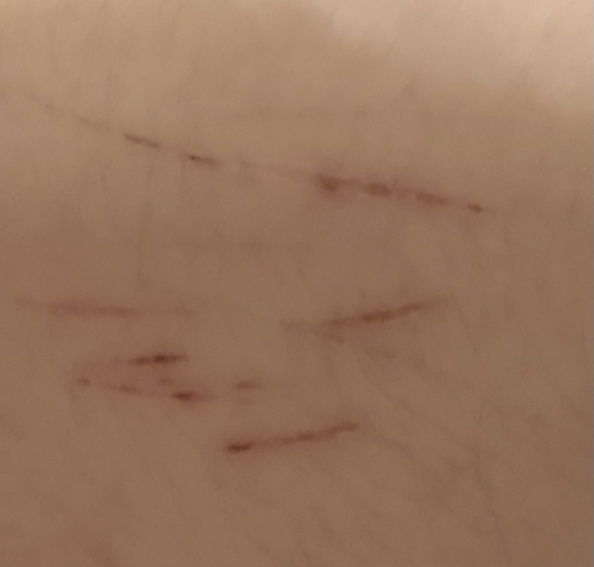 _sauntereddown's tweet photo. SFX!!! Not posting on priv since they aren’t fresh

Aanway will these heal in a week?? I’m assuming so…. #gulp https://t.co/IuCUpkaHqu