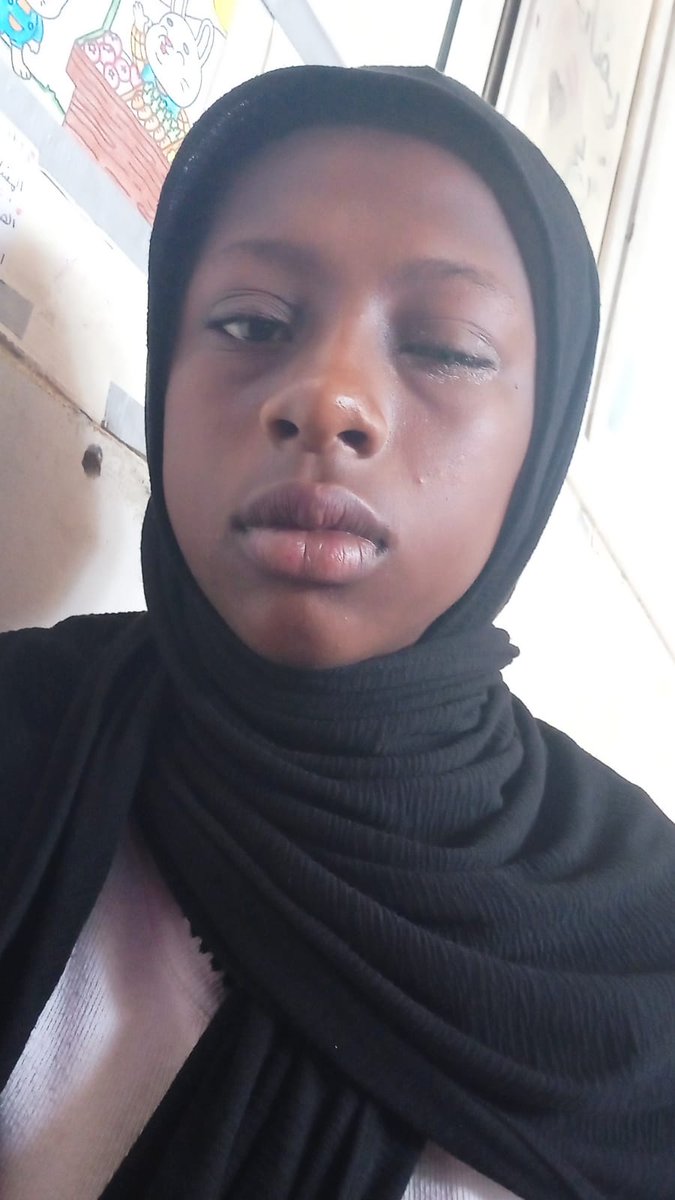 yousef_nad34430's tweet photo. So far, there has been no response to my appeal
All I ask for is medicine for my eyes😭
I am in pain💔
https://t.co/CpC1ZuNFJu https://t.co/qNCOY2JLum