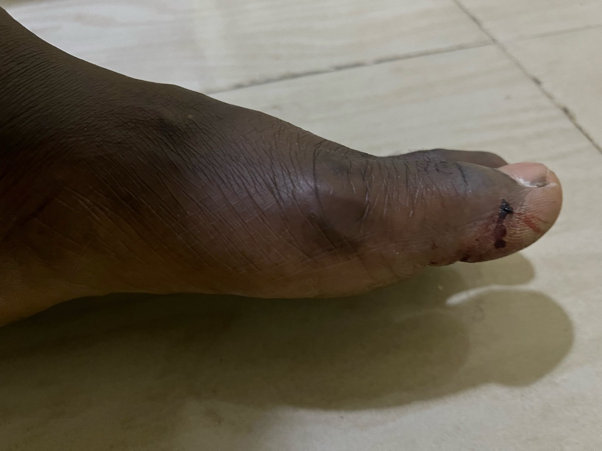 PhilipObaji's tweet photo. When I was arrested, detained &amp; tortured by Central African soldiers on the orders of Russian mercenaries who targeted me for exposing several of their crimes, you all stood by me. You still stand by me. Thank you for everything. Please keep supporting me:
https://t.co/BV0P2MY56Q https://t.co/Quzpt2jcsD