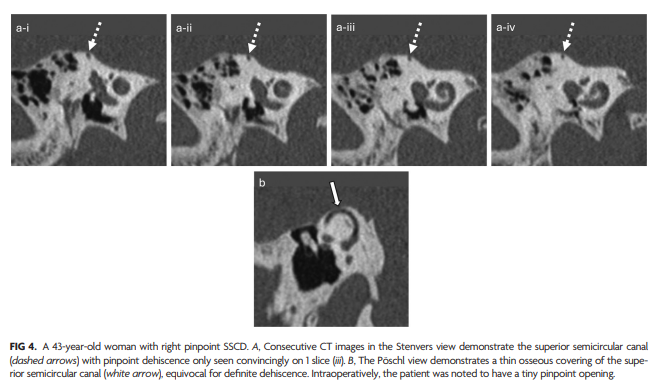 Meei Radiologist