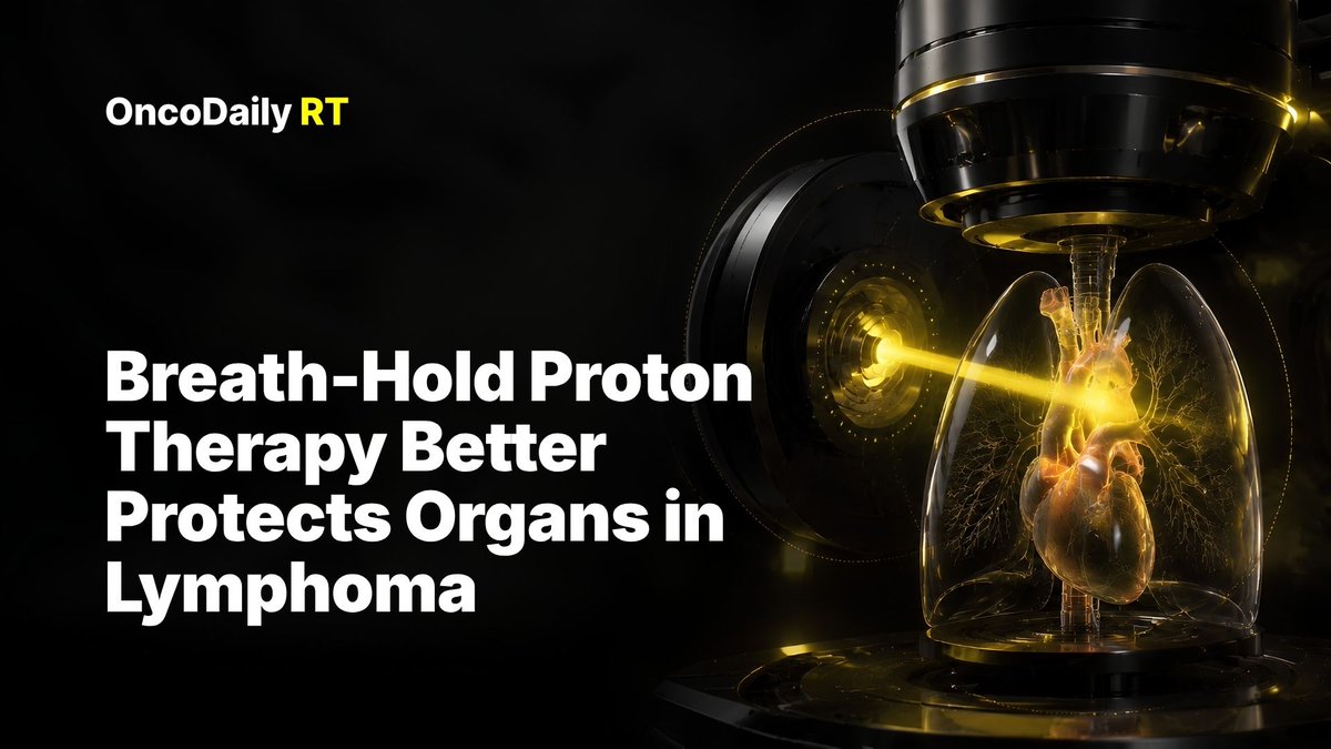 OncoDailyRT's tweet photo. New in Physics and Imaging in Radiation Oncology

In 58 mediastinal lymphoma patients, IMPT with breath hold achieved the lowest average organ doses compared with VMAT free breathing, VMAT breath hold, and IMPT free breathing.

Mean heart dose
5.4 Gy with IMPT breath hold vs 8.0 Gy with VMAT free breathing
Mean lung dose
6.7 Gy vs 9.2 Gy

Bilateral mean breast dose
2.1 Gy with IMPT vs 3.2 Gy with VMAT
IMPT techniques were optimal for at least 69% of patients, but the best technique varied individually.

For young lymphoma survivors, organ sparing is long-term survivorship care.

https://t.co/Z2DyI5xd2z