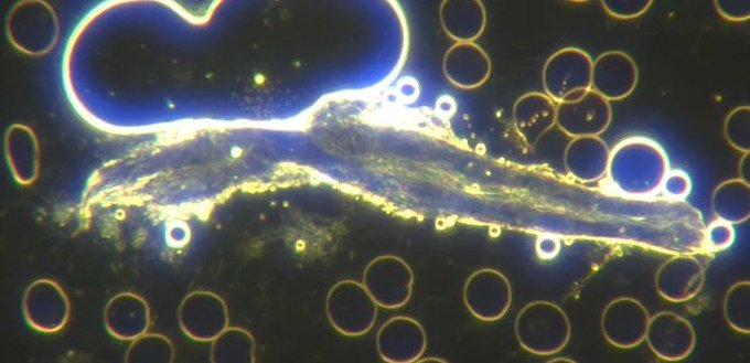 Anti5GWarrior's tweet photo. New evidence which connects COVID-19 injections, nanotechnology and <5G/6G wireless networks; with full knowledge from within DARPA and its collegiate relationships alongside governments, universities, NGOs and standards/health agencies. 💉🛜☢️

'COVID' was long-planned. 🧵 https://t.co/FtSlpgN8jk
