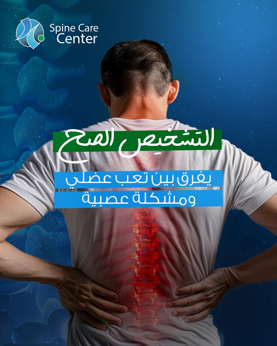 basemhenri's tweet photo. 📌 ما هو ألم والتهاب جذور الأعصاب؟

🔹 الموقع:
يحدث في الفقرات القطنية أو العنقية من العمود الفقري، حيث تخرج جذور الأعصاب التي تنقل الإحساس والحركة إلى الأطراف.
🔹 السبب:
قد يؤدي الضغط ��لى جذر العصب أو حدوث التهاب حوله إلى اضطراب في نقل الإشارات العصبية، مما يسبب الألم والأعراض المصاحبة.

🔹 النتيجة:
ظهور ألم يمتد على مسار العصب، غالبًا من أسفل الظهر إلى الساق (كما في عرق النسا)، أو من الرقبة إلى الذراع، وقد يصاحبه تنميل أو ضعف في العضلات.
🩺 الأعراض التي قد يشعر بها المريض

✅ ألم حارق أو حاد يمتد من الظهر إلى الساق أو من الرقبة إلى الذراع.
✅ تنميل أو وخز في الأطراف.
✅ ضعف في العضلات أو صعوبة في الحركة والوقوف لفترات طويلة.
✅ زيادة الألم أثناء الجلوس، أو الانحناء، أو بعد فترات الراحة الطويلة.
✅ اضطرابات في النوم بسبب استمرار الألم.
