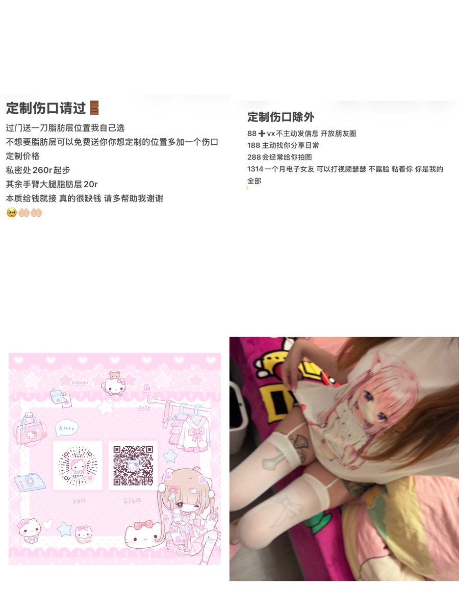 恋の痛み tweet media